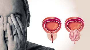 Zdravá a zapálená prostata