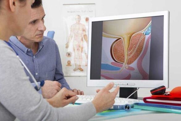 lekár konzultuje s pacientom otázku prostatitídy